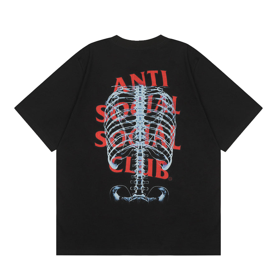 Anti Social Social Club shirt